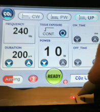 Load image into Gallery viewer, Gently used DEMO ML30 30W CO2 Surgical Laser